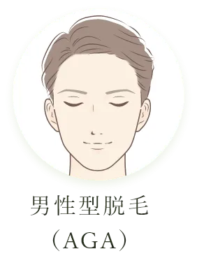 男性型脱毛（AGA）