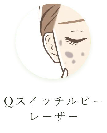 Qスイッチルビーレーザー